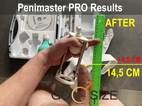 penimaster pro before after|Results with the penimaster pro : r/gettingbigger .